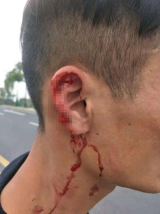 聊城出租车和滴滴打架,出租车和乘客打架的案例